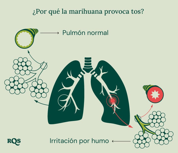 Diagrama del pulmón sano vs. pulmón irritado con inflamación y bronquios hinchados causados por fumar marihuana.